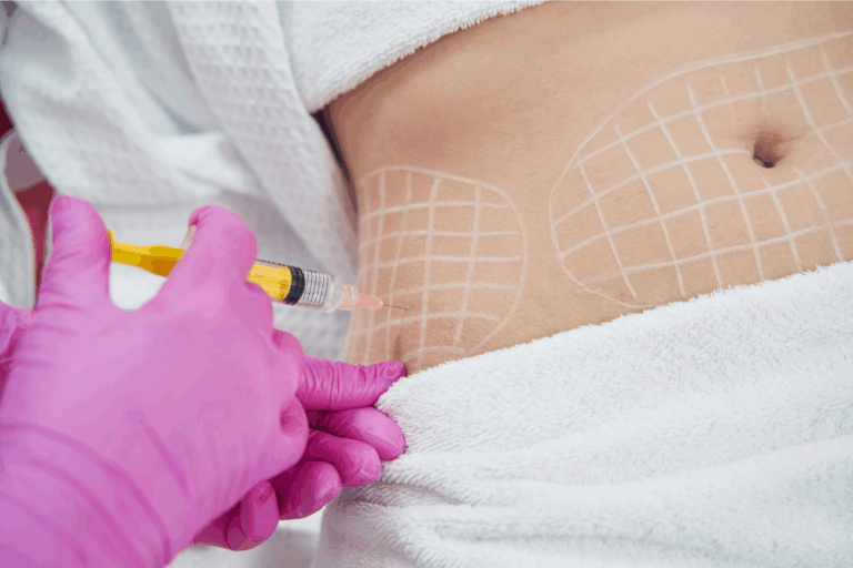 Tummy Lipo PCDC in DeBary, Florida
