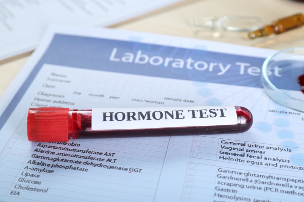 Hormone Testing and Metabolism Support Near Winter Springs, FL: Why More Men and Women Are Looking Into This