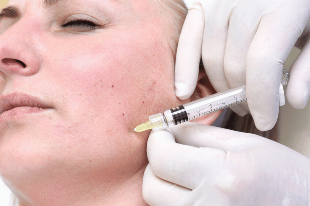Best Dermal Filler Results Heathrow FL