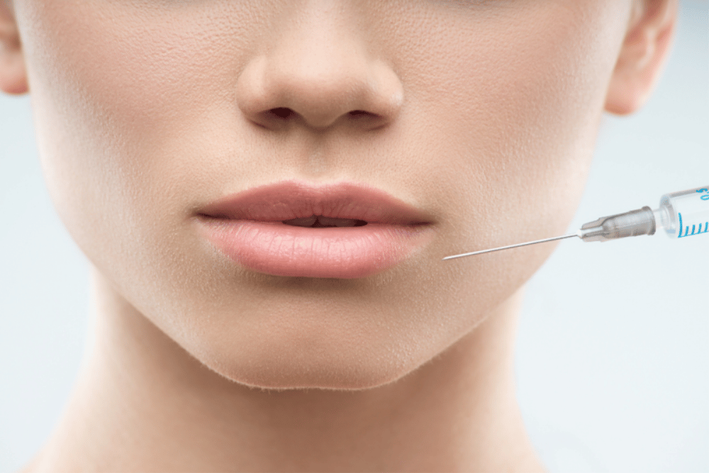 Lip Filler Cost Longwood FL