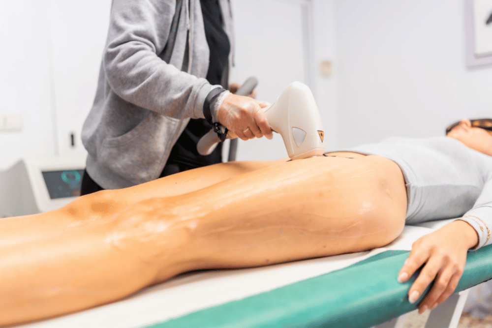 Laser Hair Removal Cost DeBary FL
