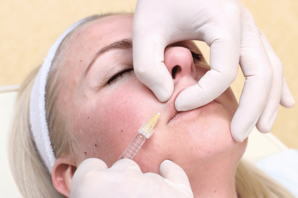 Lip Filler Treatments in Sanford FL