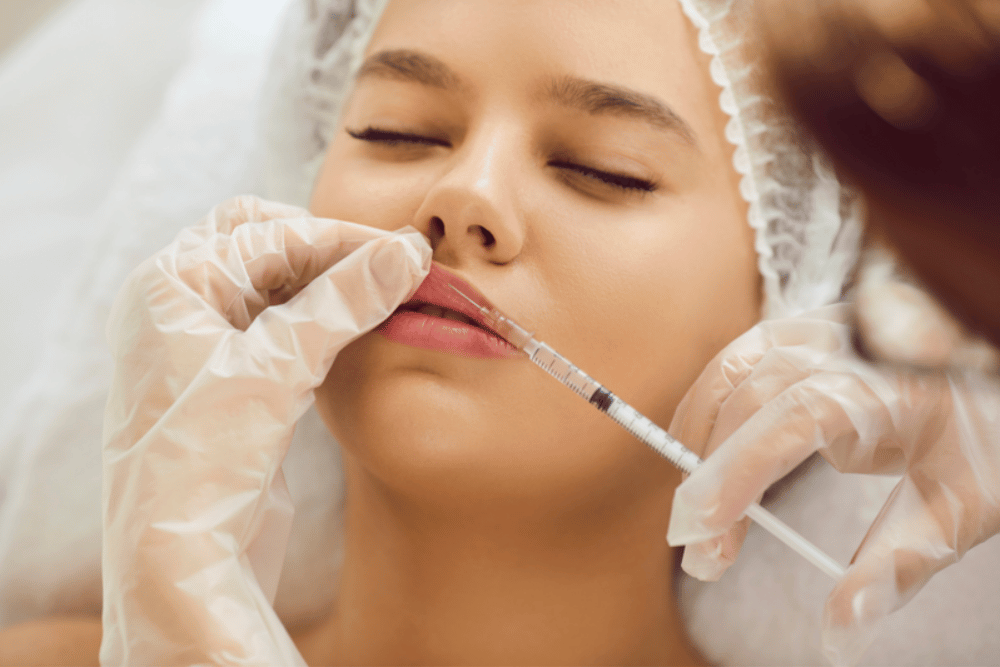 Mini Lip Filler Treatments in DeBary FL