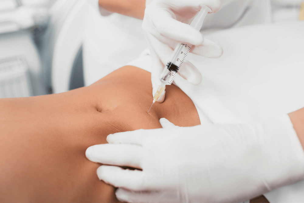 Mini Liposuction Heathrow FL