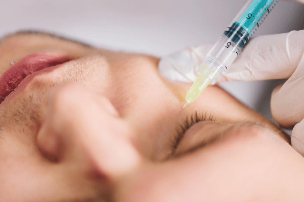 Under eye filler consultations in Mount Dora FL
