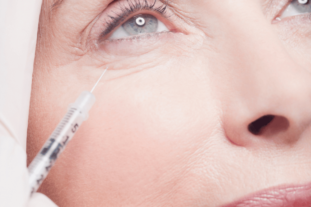 Under Eye Filler Consultations in Sanford FL
