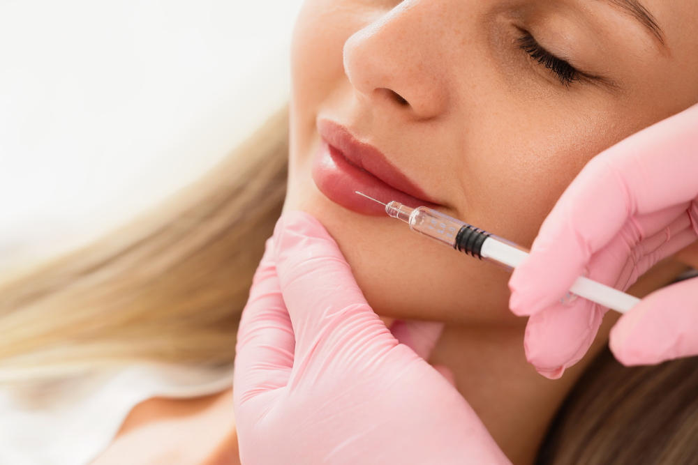 Best Lip Filler Appointments Near Deltona and Orange City